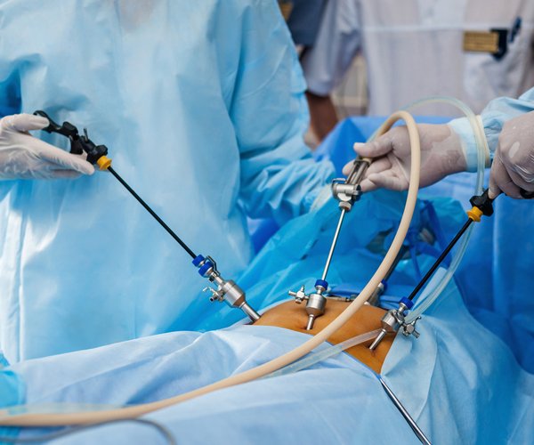 The Advancements and Benefits of Gynecologic Laparoscopic Surgery.