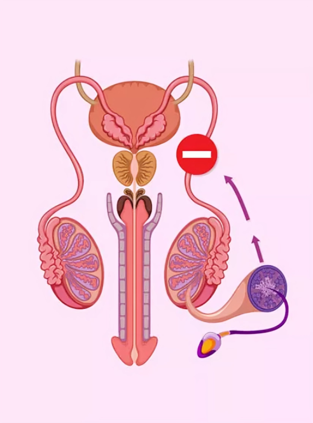 Navigating Intimacy A Closer Look At Erectile Dysfunction