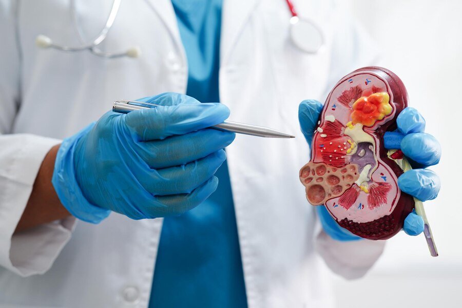 Promising Biomarkers For Early Detection Of Kidney Cancer