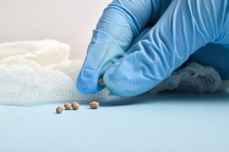 Painful Problem: The Causes And Treatments For Bladder Stones