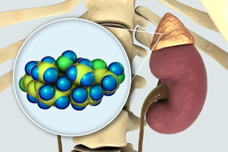 Ureteric Stone Treatment in Tri Nagar