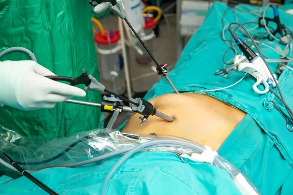 Best Laparoscopic hysterectomy surgery in North Delhi