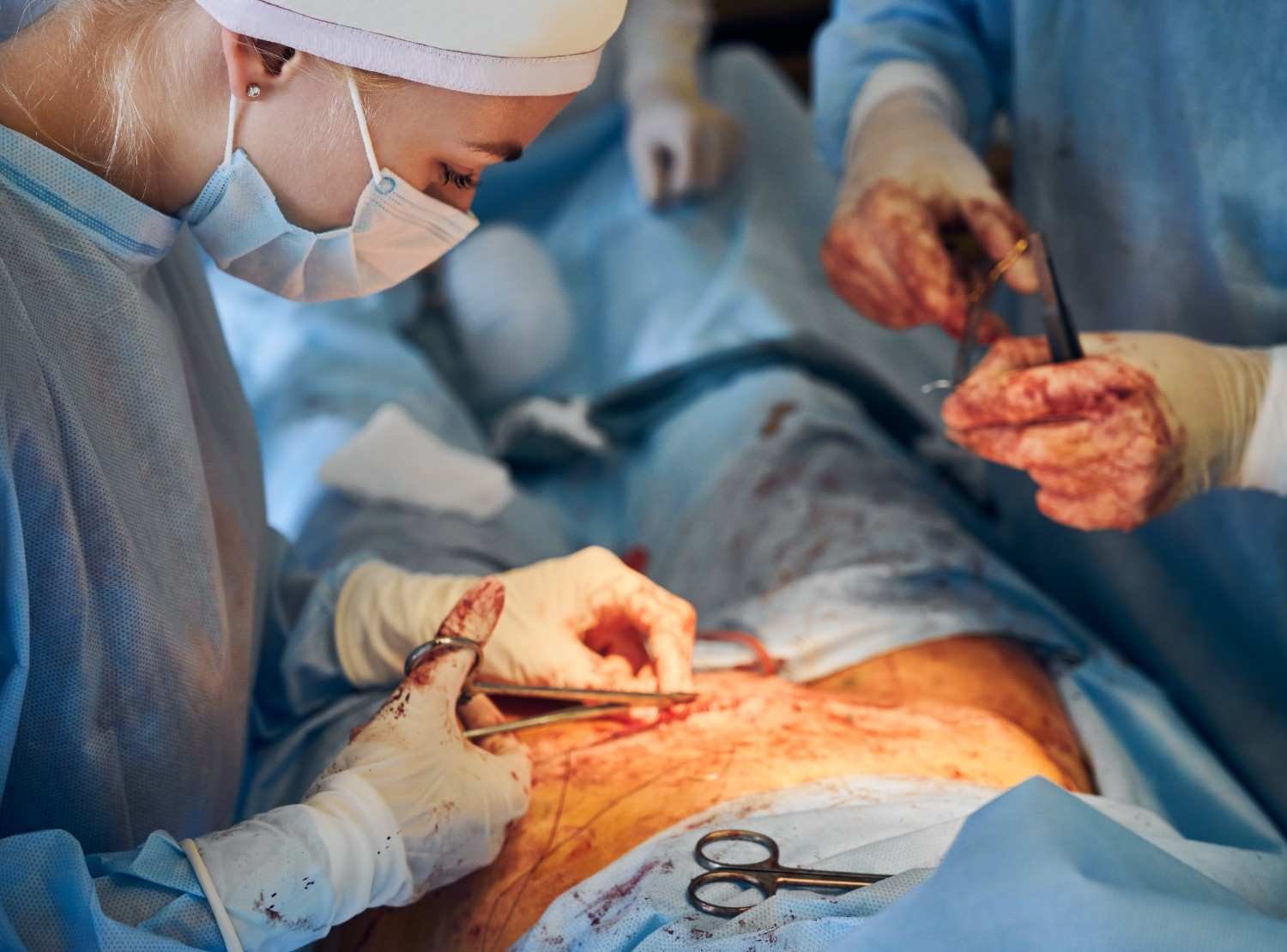 Best Laparotomy Treatment in North Delhi