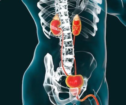 Best Ureteric Stone Specialist in Delhi