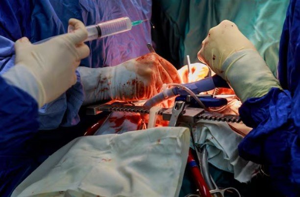 Best Kidney Stone Surgery in Pitampura