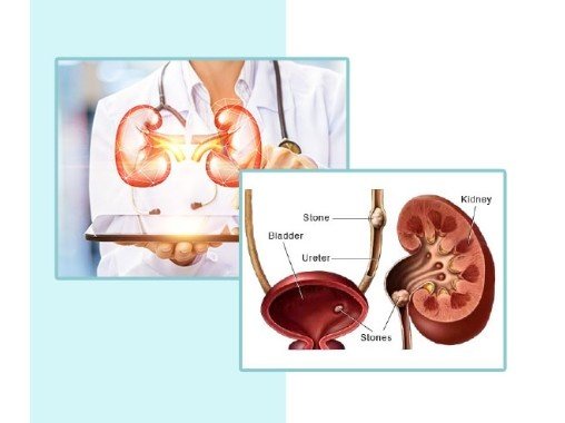 Urological Treatment Centre